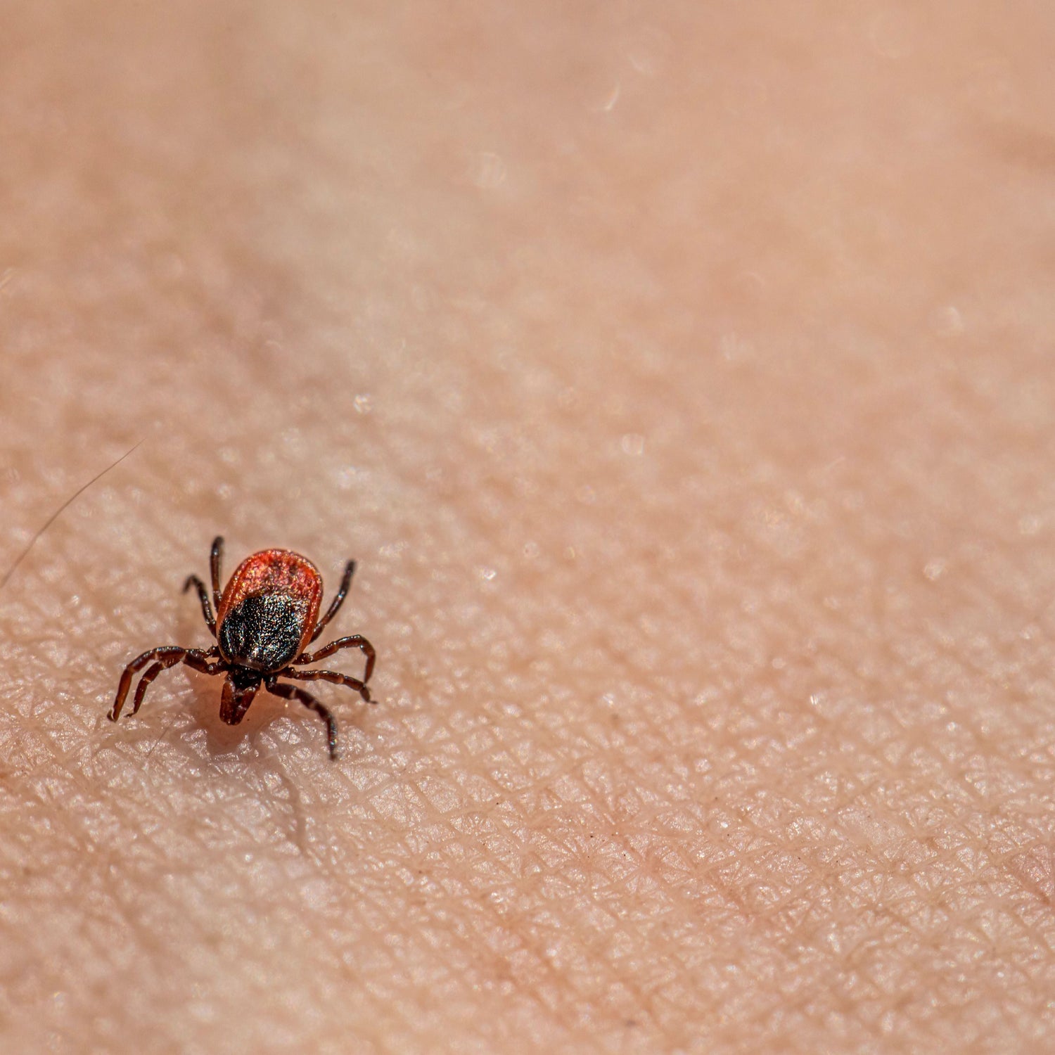 A close-up macro shot of a small red and black tick on human skin.
